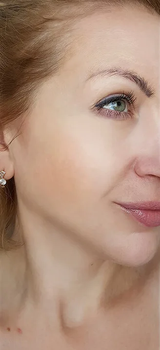 Лазерное омоложение лица — после процедуры